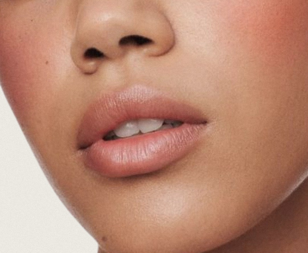 relleno facial acido